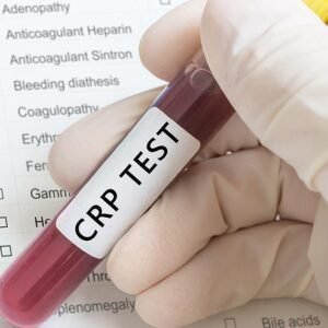 C-reactive protein (CRP)