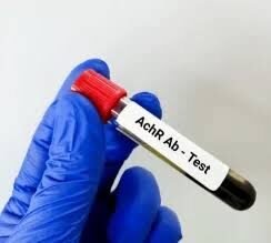 Acetyl Choline Receptor Antibody (ACHR-Ab)