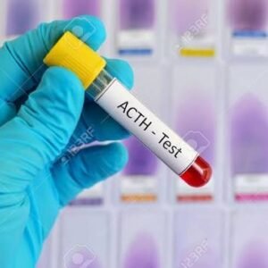 Adreno Corticotrophic Hormone (ACTH)