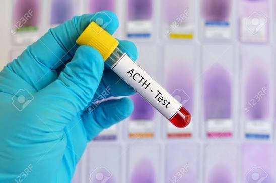 Adreno Corticotrophic Hormone (ACTH)