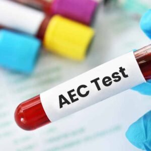 Absolute Eosinophil Count