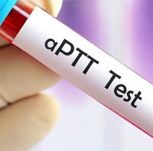 Activated Partial Thromboplastin Time (APTT)
