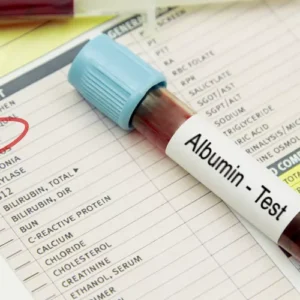 Albumin, Serum
