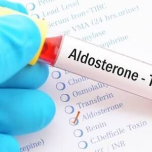 Aldosterone – Serum
