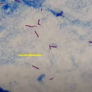 Acid-Fast Bacilli (AFB) Susceptibility