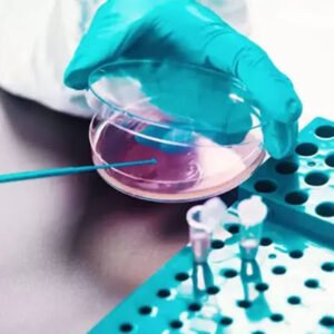 AFB Drug Susceptibility Testing – 5 Drugs