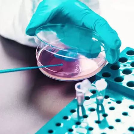 AFB Drug Susceptibility Testing – 5 Drugs