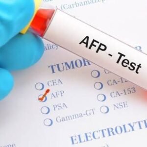 Alpha-Fetoprotein (AFP) – Amniotic Fluid