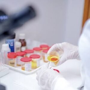 Alcohol – Urine (Random)