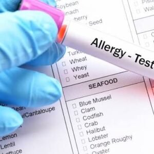 Allergy Profile - Inhalants