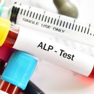 Alkaline Phosphatase (ALP)