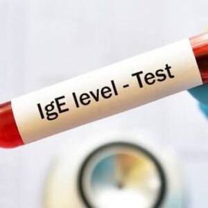 Allergy Panel – IgE, Serum