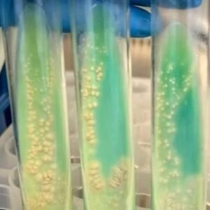 Mycobacterial Drug Susceptibility 5 Drugs Jensen (LJ)