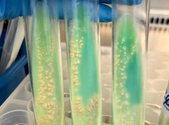 Mycobacterial Drug Susceptibility 5 Drugs Jensen (LJ)