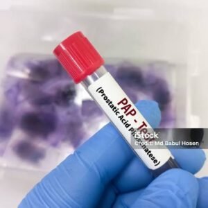 Prostatic Acid Phosphatase (PAP) – Serum